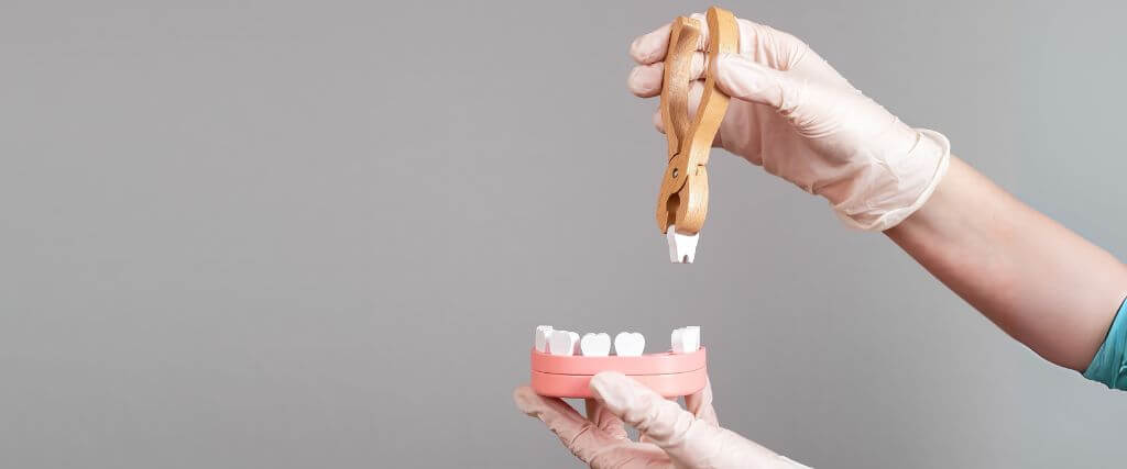 Do You Need a Bone Graft After a Tooth Extraction? What You Need to Know
