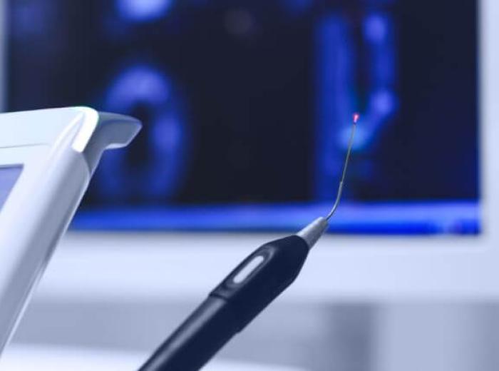 LANAP Laser Treatment for Gum Disease: How It Works and Why It’s Effective