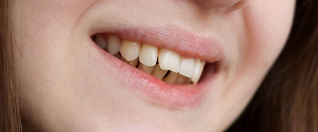 Signs You Need a Bite Adjustment and How Your Dentist Can Help